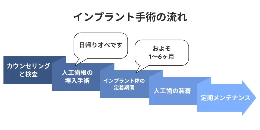 インプラント治療の流れとそれぞれの期間